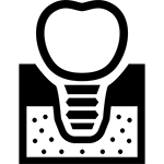 インプラント料金